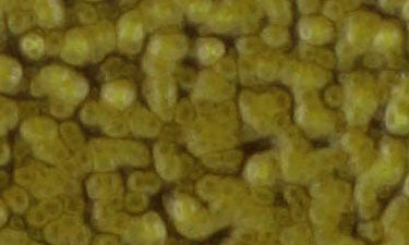 Gold Ripple (Bonded)